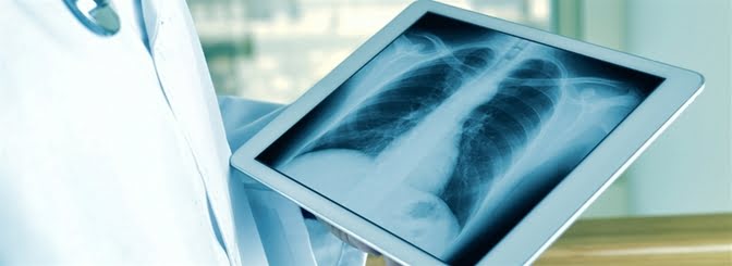 lung xray 1